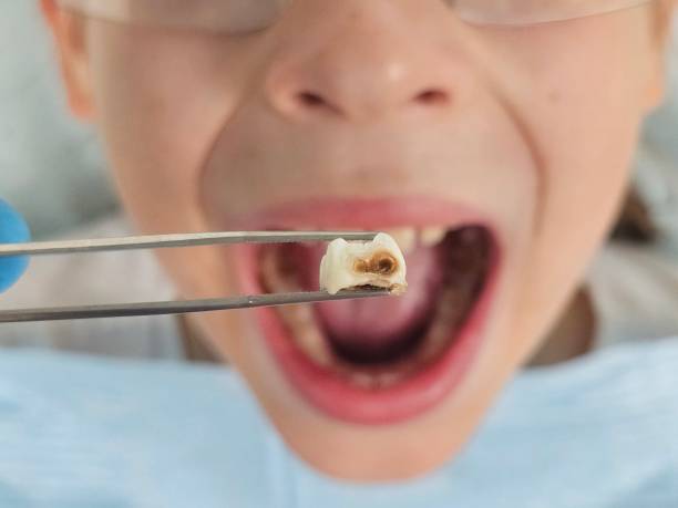 Best Emergency Orthodontic Repairs in Decatur, TX
