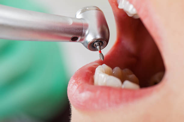Best Walk-In Emergency Dental Services in Decatur, TX